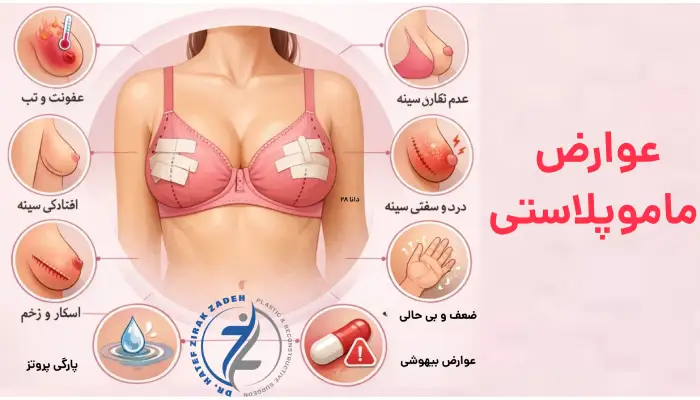 عوارض
ماموپلاستی