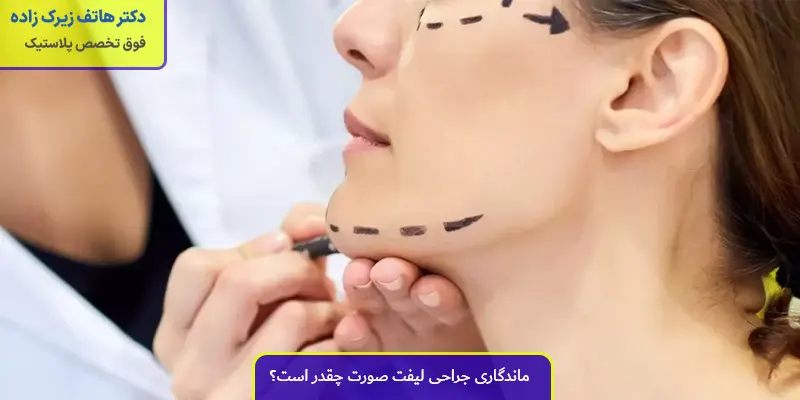 ماندگاری جراحی لیفت صورت چقدر است؟