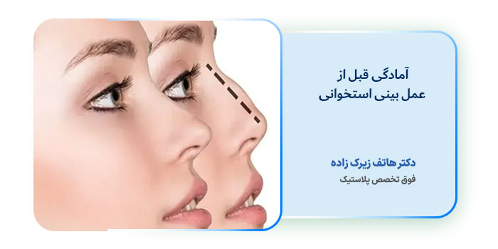 آمادگی قبل از عمل بینی استخوانی