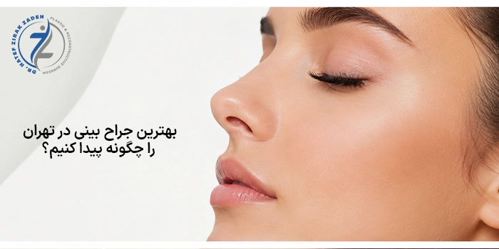 بهترین جراح بینی در تهران را چگونه پیدا کنیم؟