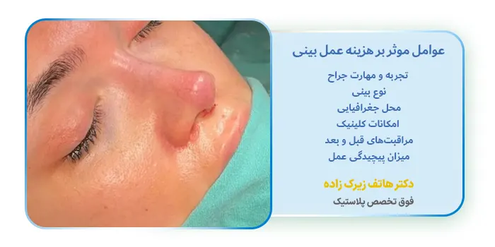 عوامل موثر بر هزینه عمل بینی