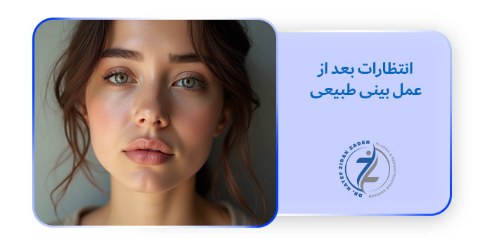 انتظارات بعد از عمل بینی طبیعی