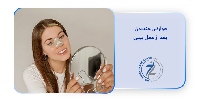 خندیدن بعد از عمل بینی