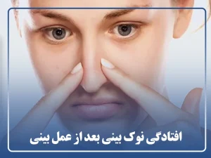 افتادگی نوک بینی بعد از عمل بینی