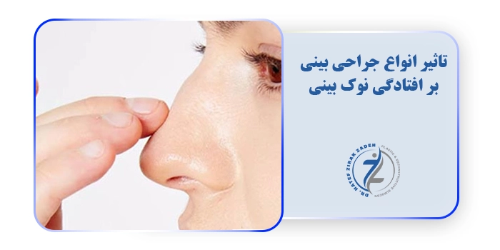 تاثیر انواع جراحی بینی بر افتادگی نوک بینی