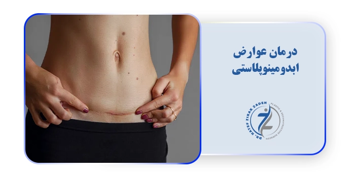 درمان عوارض ابدومینوپلاستی