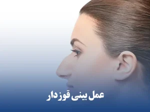 عمل بینی قوزدار