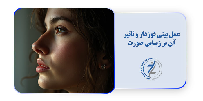 عمل بینی قوزدار و تاثیر آن بر زیبایی صورت