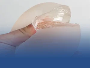 ترکیدن پروتز سینه