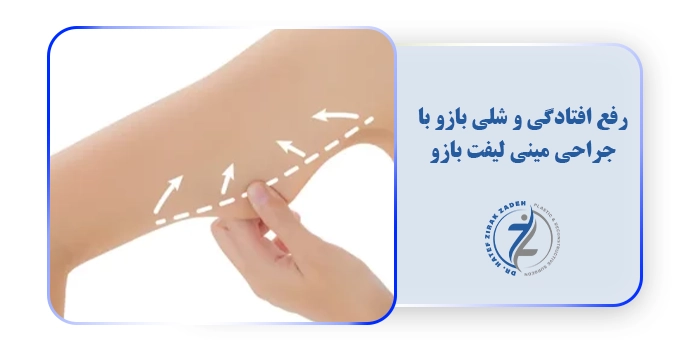 رفع افتادگی و شلی بازو با جراحی مینی لیفت بازو