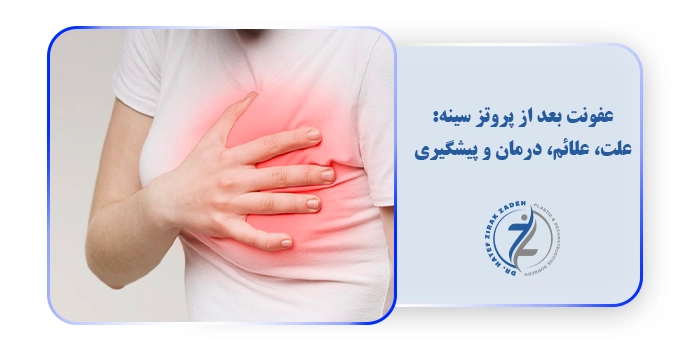 عفونت بعد از پروتز سینه: علت، علائم، درمان و پیشگیری