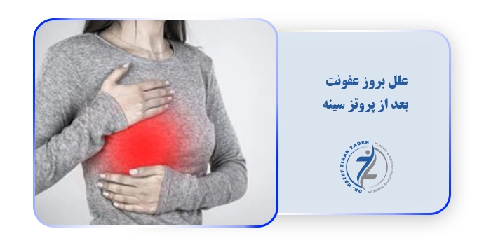علل بروز عفونت بعد از پروتز سینه