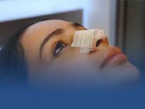 عوارض عمل بینی