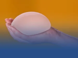 ماندگاری پروتز سینه