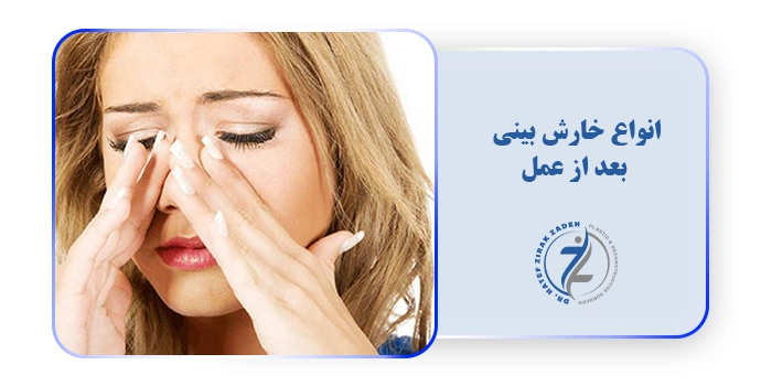 انواع خارش بینی بعد از عمل