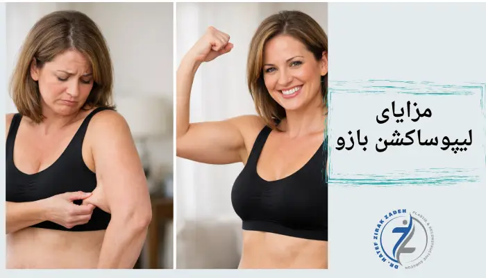 مزایای
لیپوساکشن بازو