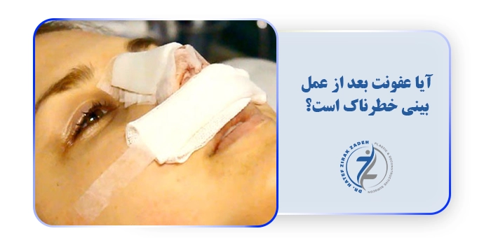 آیا عفونت بعد از عمل بینی خطرناک است؟
