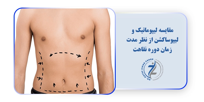 مقایسه لیپوماتیک و لیپوساکشن از نظر مدت زمان دوره نقاهت