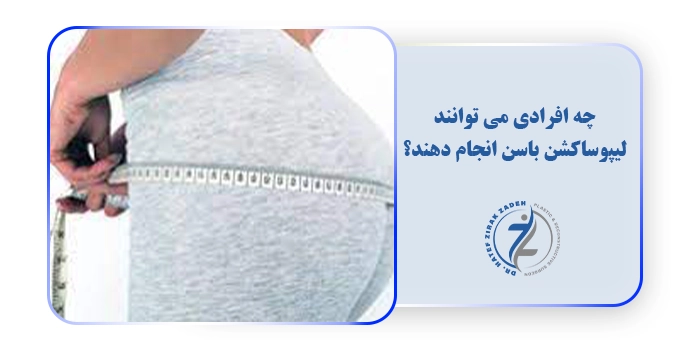 چه افرادی می توانند لیپوساکشن باسن انجام دهند؟