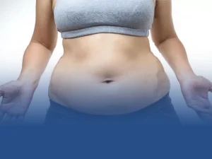 تجمع مایع بعد از لیپوساکشن