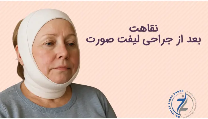 نقاهت بعد از جراحی لیفت صورت