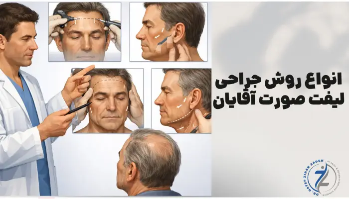 مراحل جراحی لیفت صورت آقایان