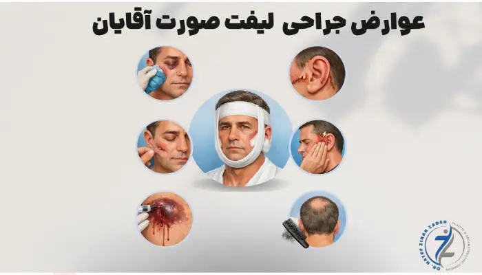 عوارض جراحی لیفت صورت آقایان