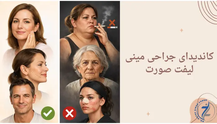 کاندیدای جراحی مینی لیفت صورت