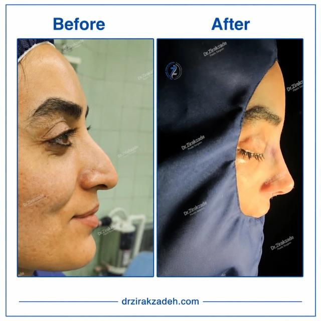 نمونه کار عمل بینی