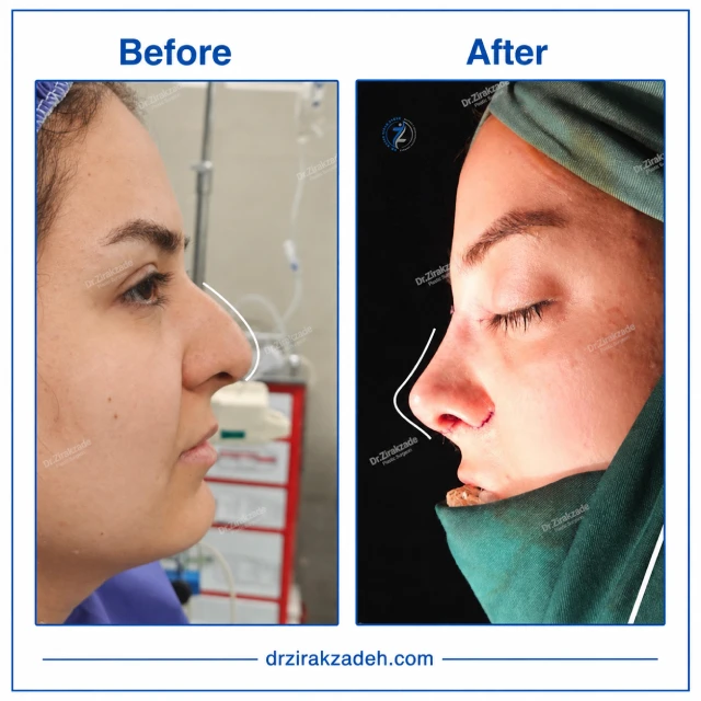نمونه کار عمل بینی